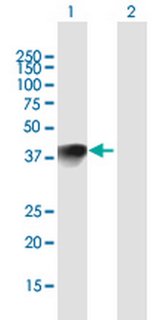 HMX1 Antibody in Western Blot (WB)