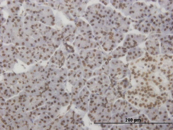HMX2 Antibody in Immunohistochemistry (Paraffin) (IHC (P))