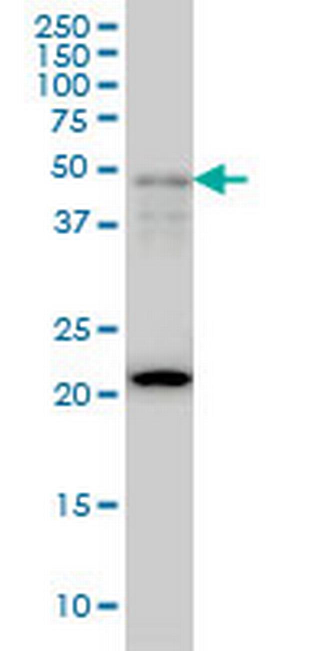 FOXA2 Antibody in Western Blot (WB)