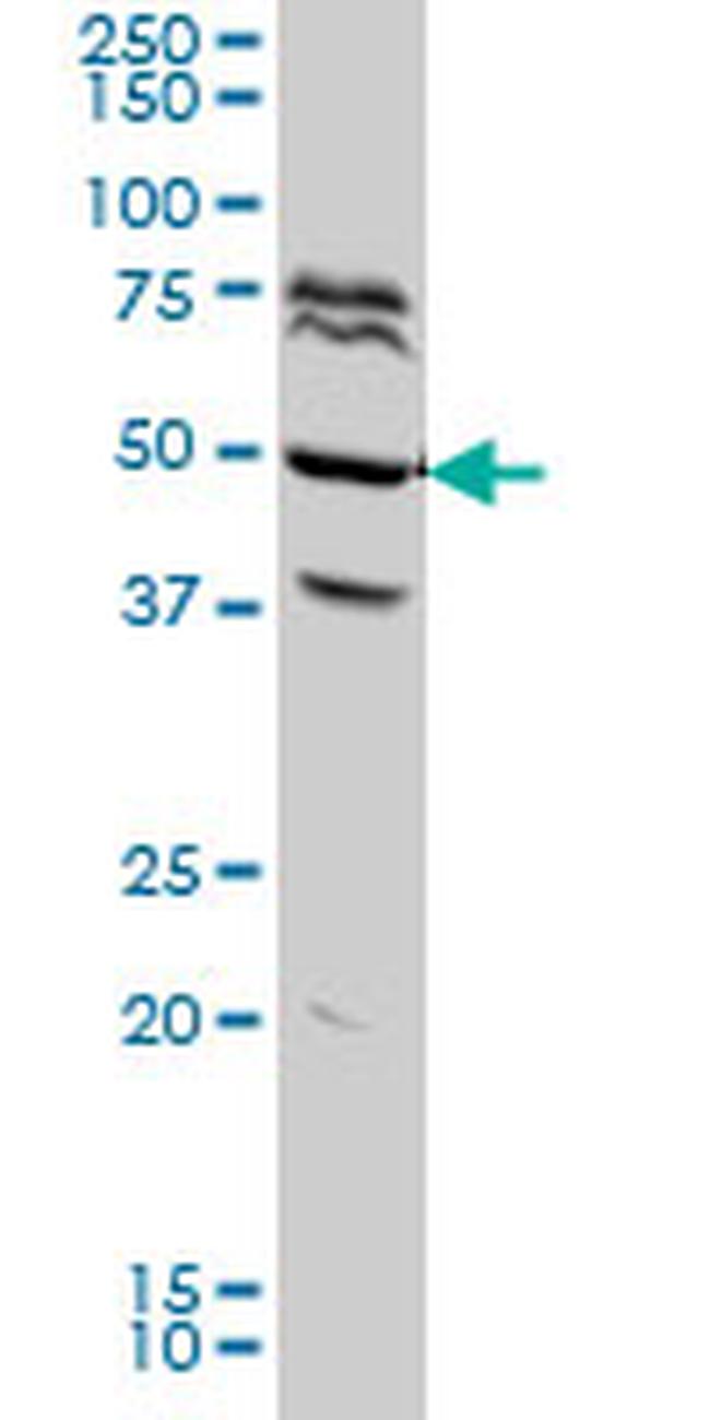 FOXA2 Antibody in Western Blot (WB)