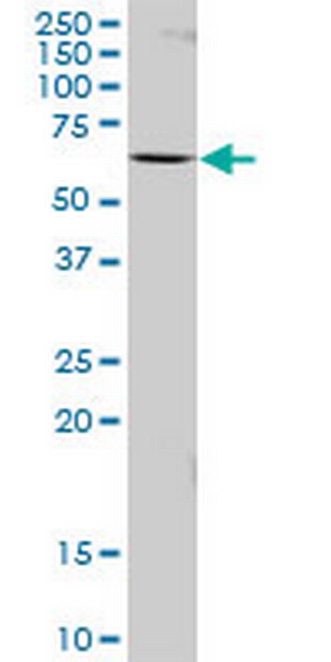 HNRNPL Antibody in Western Blot (WB)