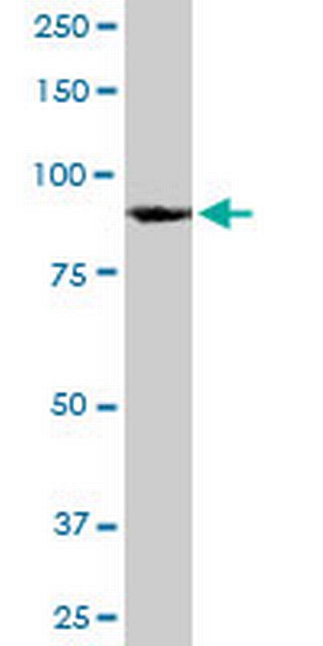 HNRNPU Antibody in Western Blot (WB)