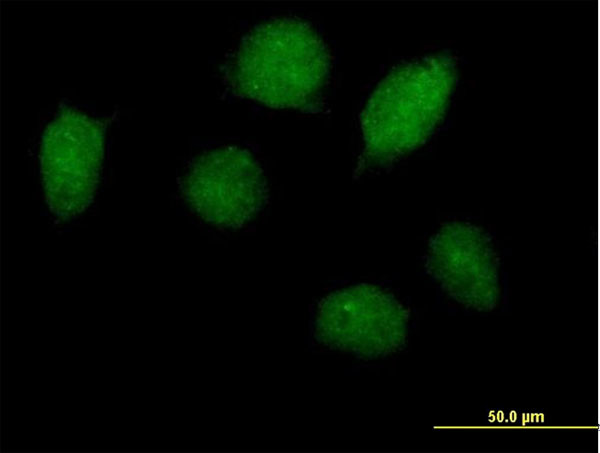 HOXA1 Antibody in Immunocytochemistry (ICC/IF)