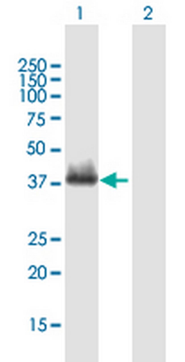HOXA4 Antibody in Western Blot (WB)