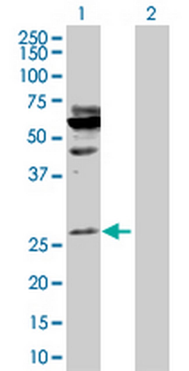 HOXA5 Antibody in Western Blot (WB)