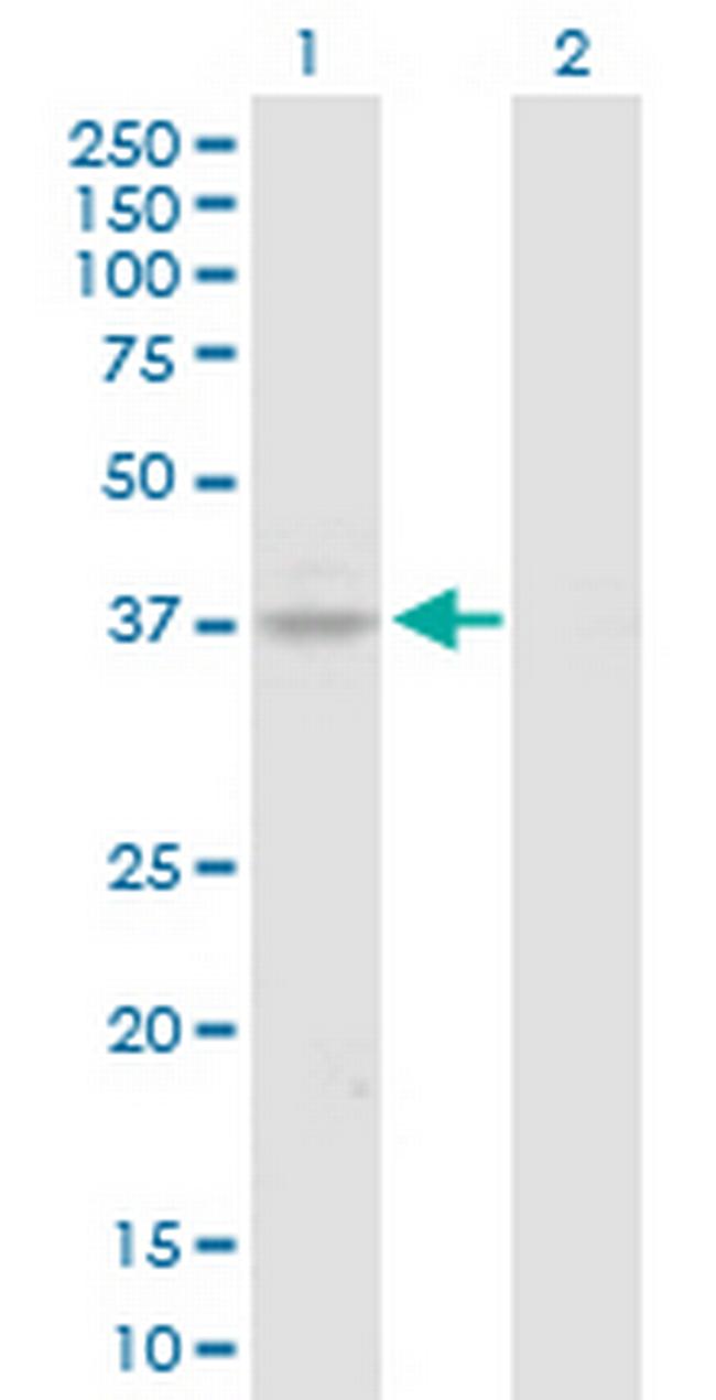 HOXA7 Antibody in Western Blot (WB)