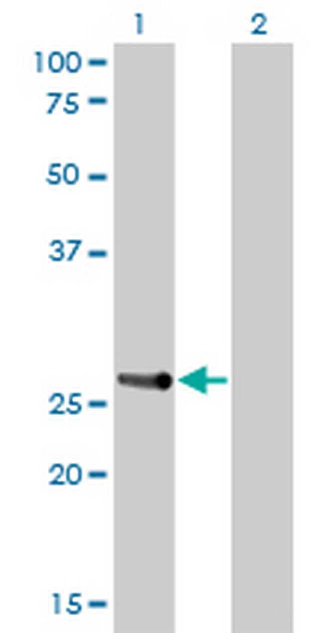 HOXA7 Antibody in Western Blot (WB)