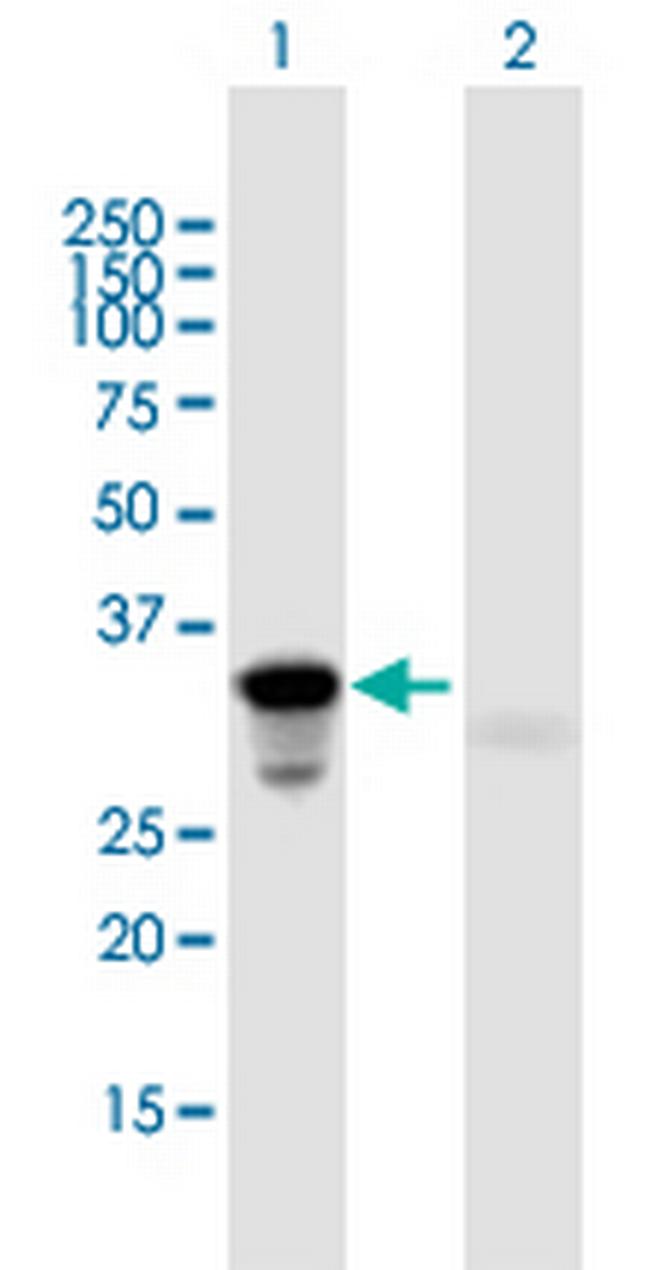 HOXA9 Antibody in Western Blot (WB)
