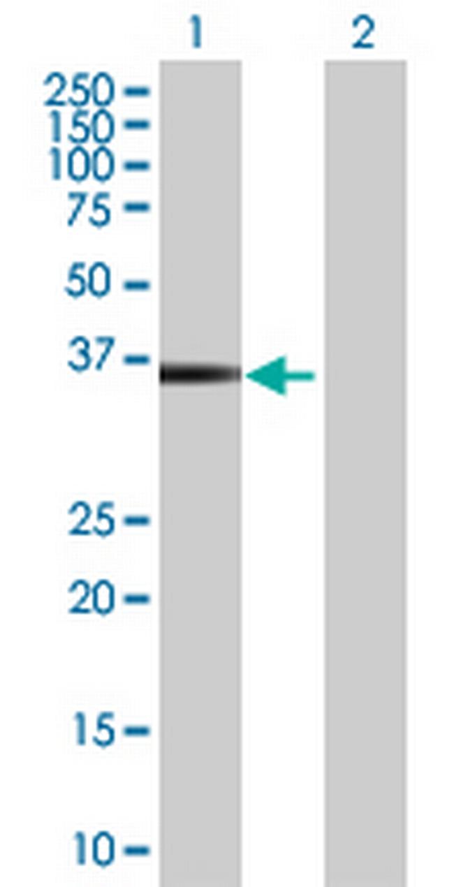 HOXB5 Antibody in Western Blot (WB)