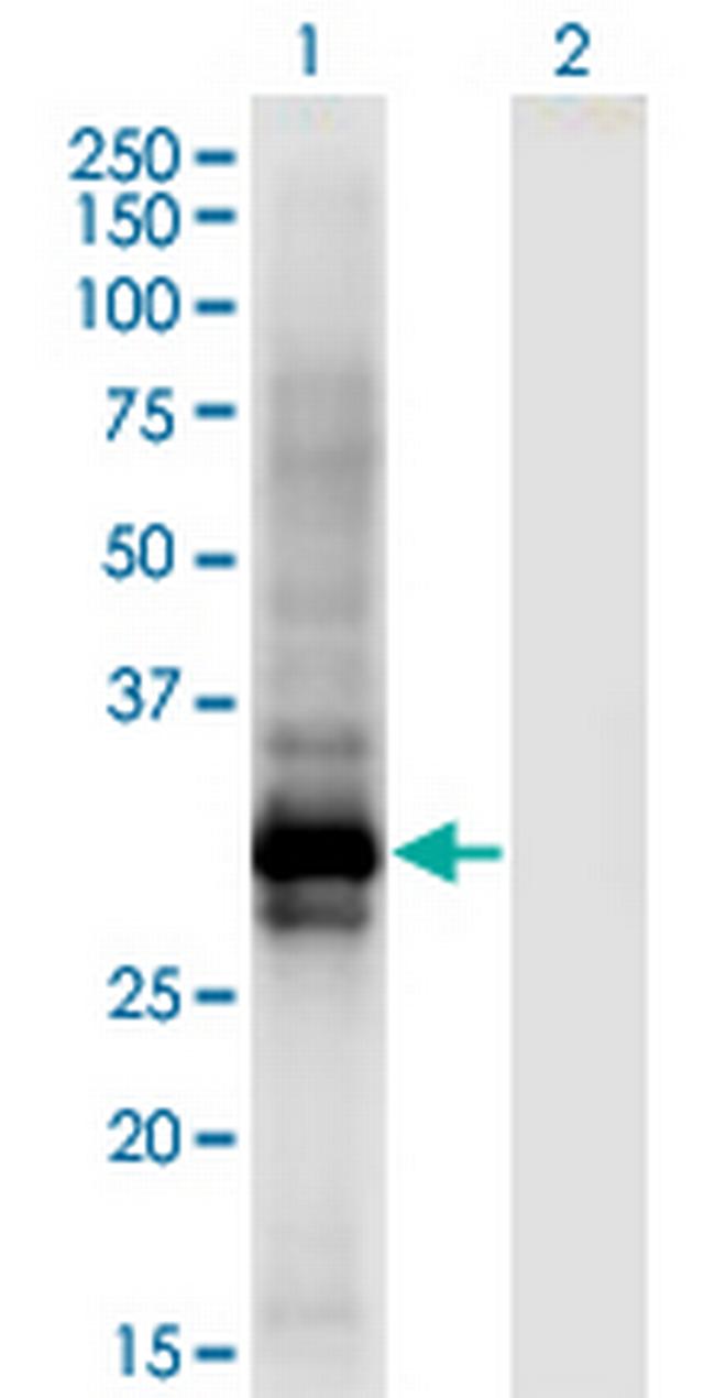 HOXB6 Antibody in Western Blot (WB)