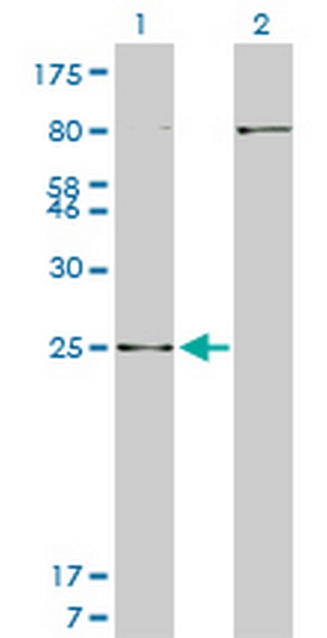 HOXB7 Antibody in Western Blot (WB)