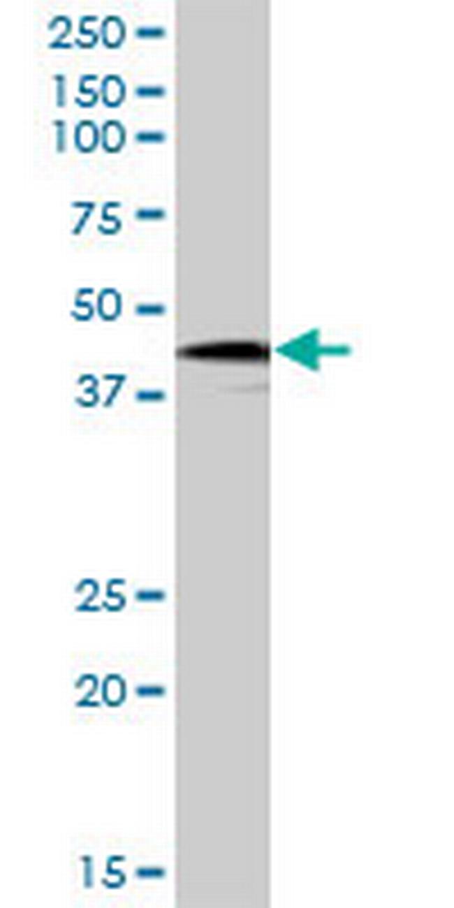 HOXB9 Antibody in Western Blot (WB)