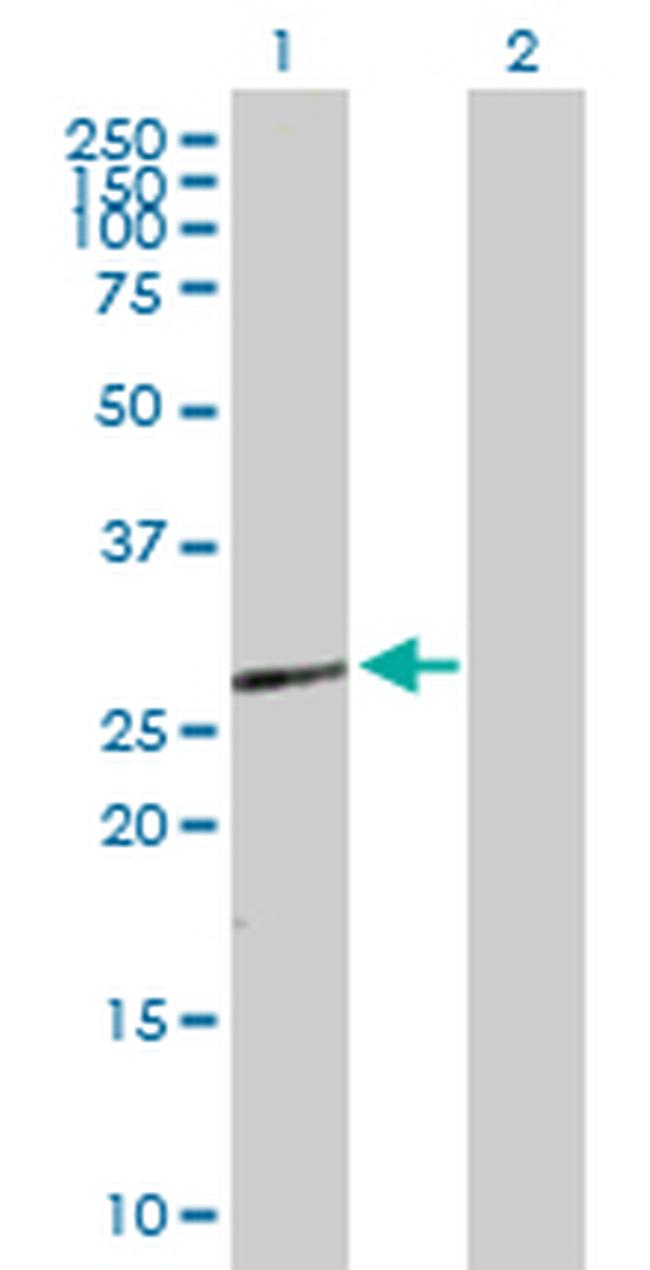 HOXB9 Antibody in Western Blot (WB)