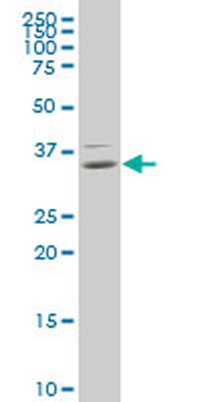 HOXB9 Antibody in Western Blot (WB)