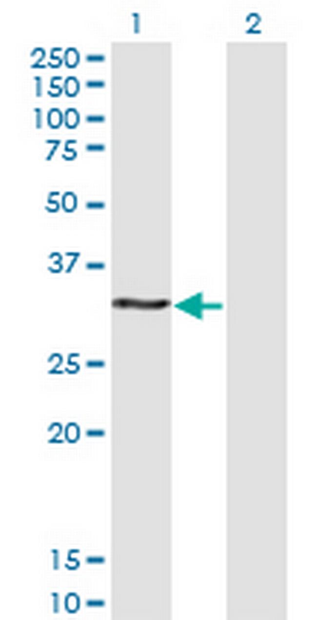 HOXB9 Antibody in Western Blot (WB)