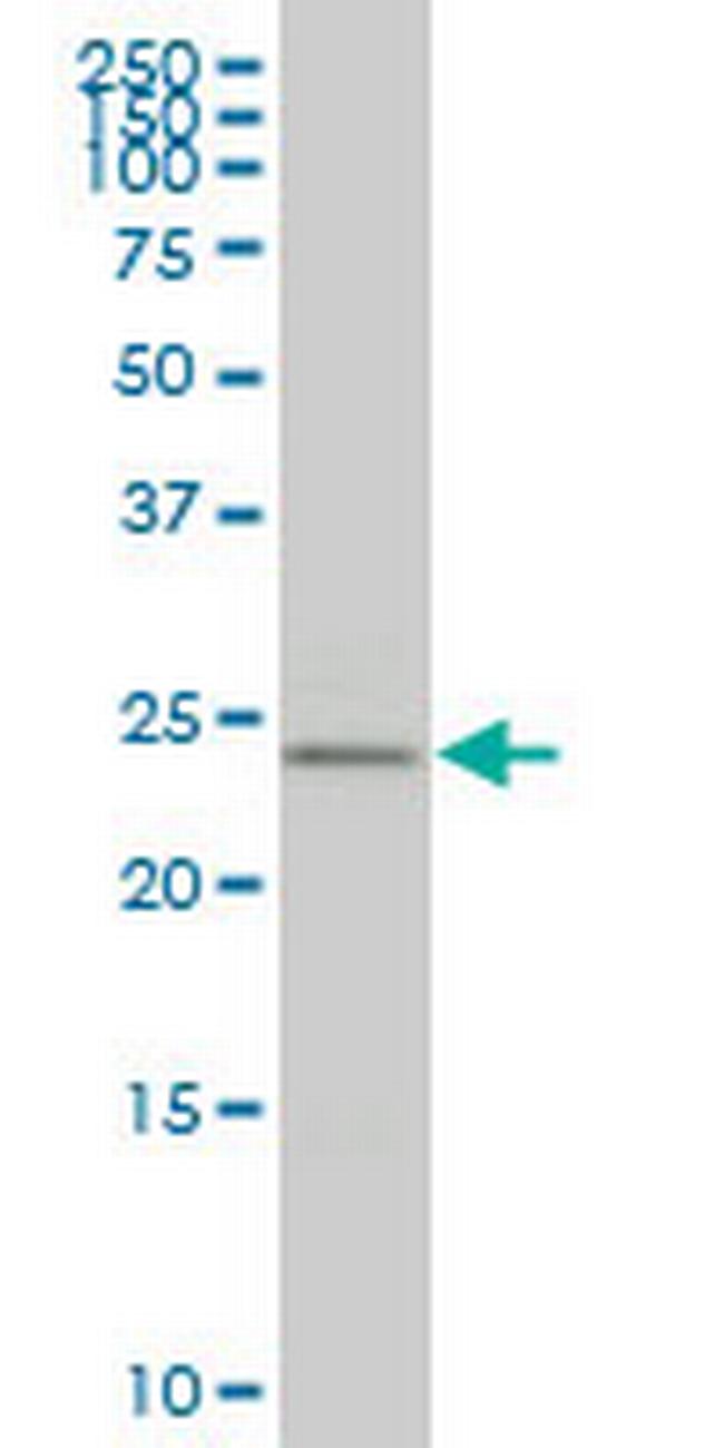 HOXB9 Antibody in Western Blot (WB)