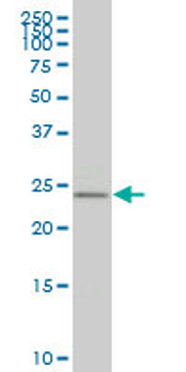 HOXB9 Antibody in Western Blot (WB)