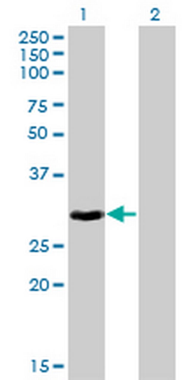 HOXB9 Antibody in Western Blot (WB)