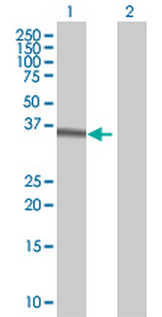 HOXC4 Antibody in Western Blot (WB)