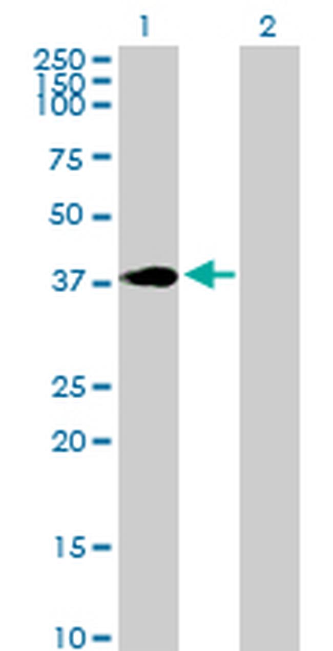 HOXC4 Antibody in Western Blot (WB)