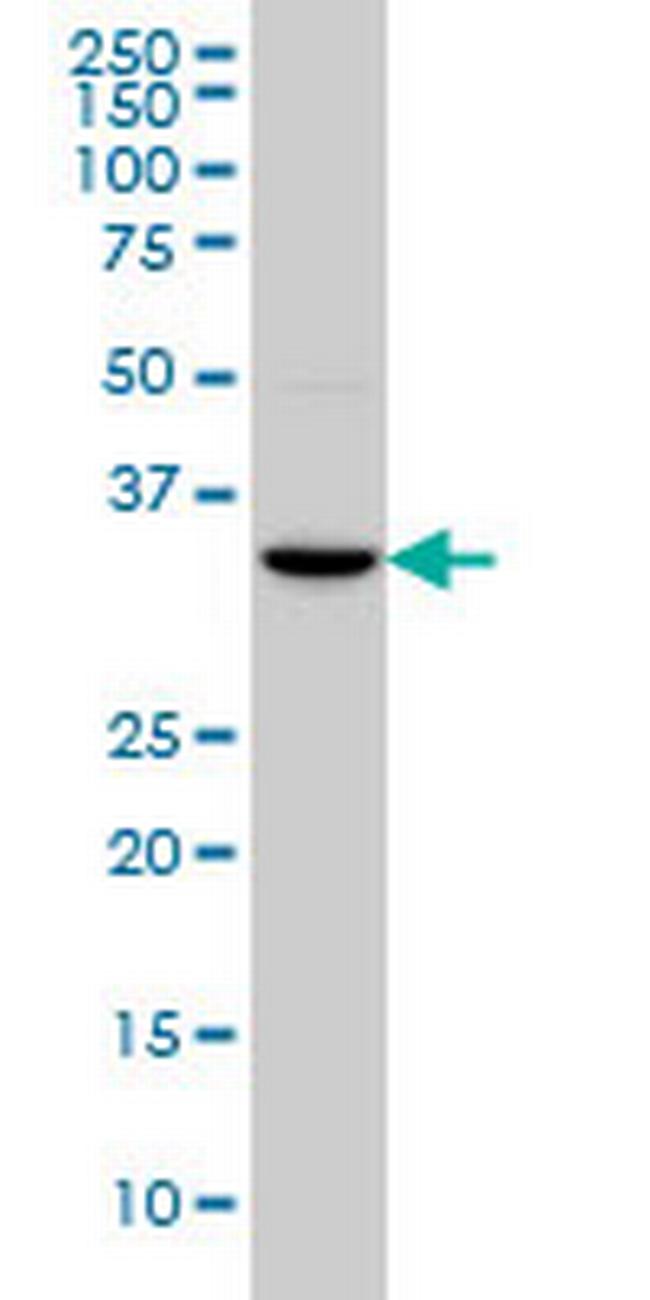 HOXC4 Antibody in Western Blot (WB)