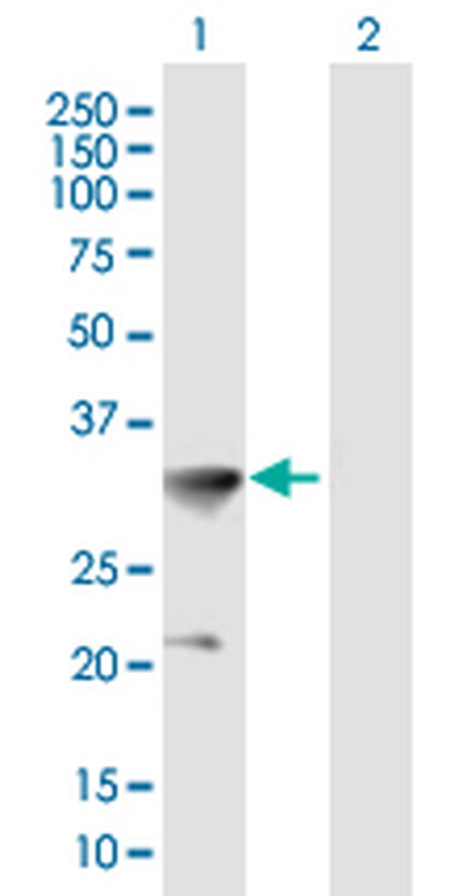 HOXC8 Antibody in Western Blot (WB)