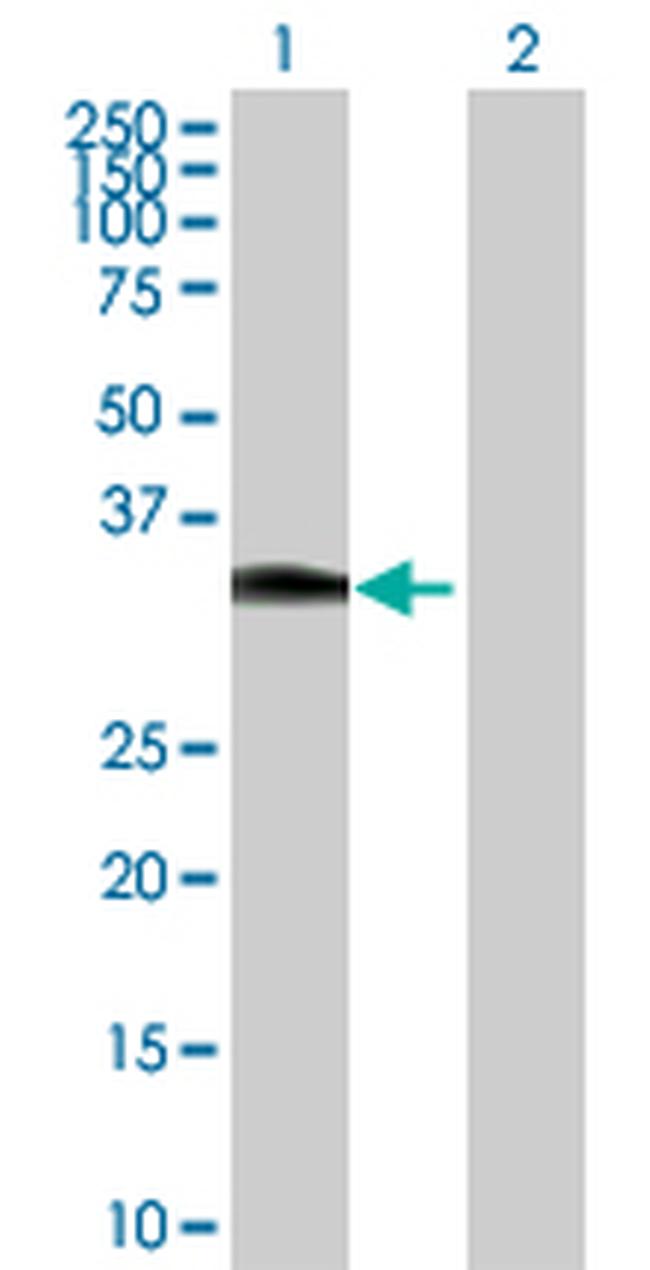 HOXC8 Antibody in Western Blot (WB)