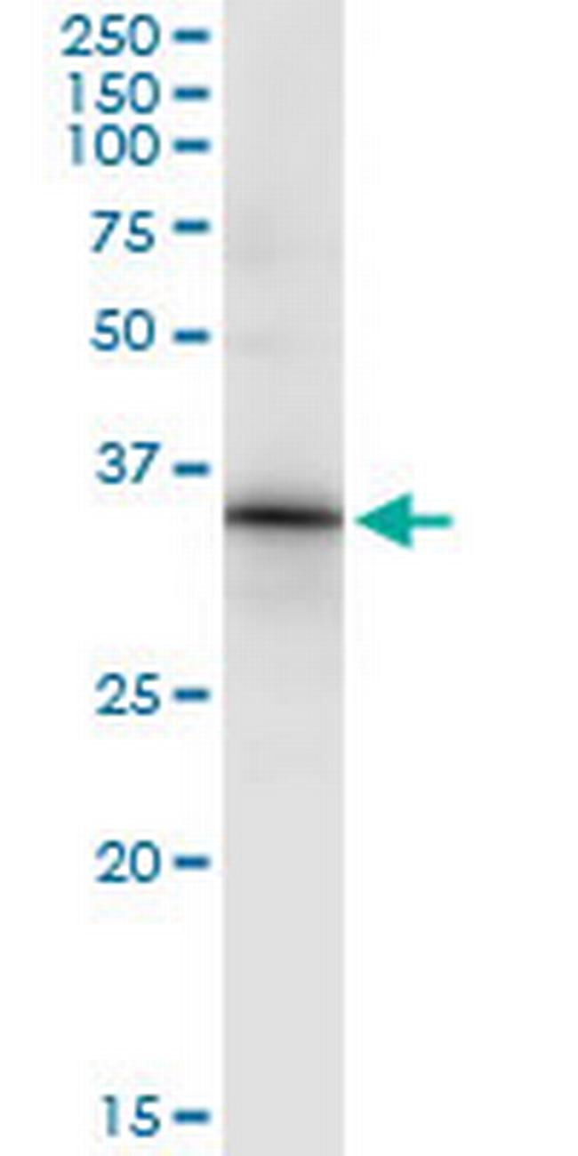 HOXC8 Antibody in Immunoprecipitation (IP)