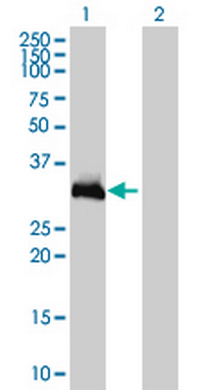 HOXC9 Antibody in Western Blot (WB)