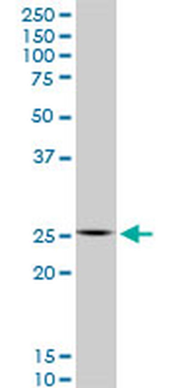 HOXC12 Antibody in Western Blot (WB)