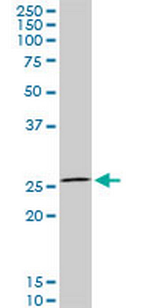 HOXC12 Antibody in Western Blot (WB)