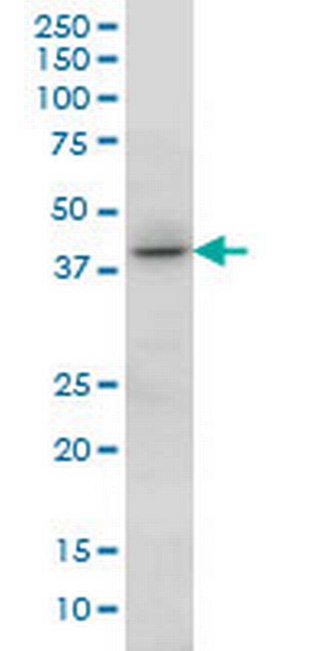 HOXC13 Antibody in Western Blot (WB)