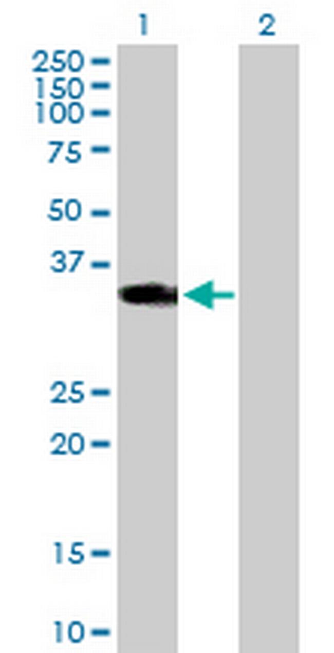 HOXD1 Antibody in Western Blot (WB)