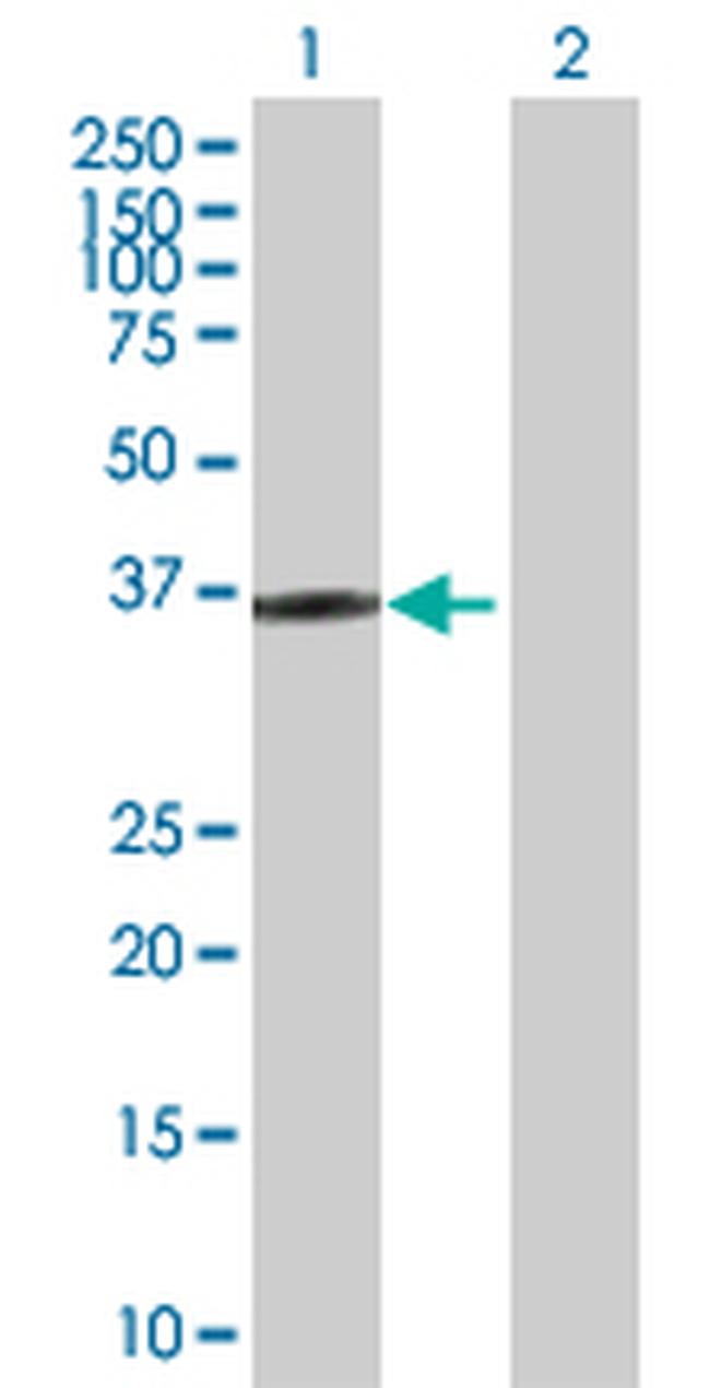 HOXD1 Antibody in Western Blot (WB)