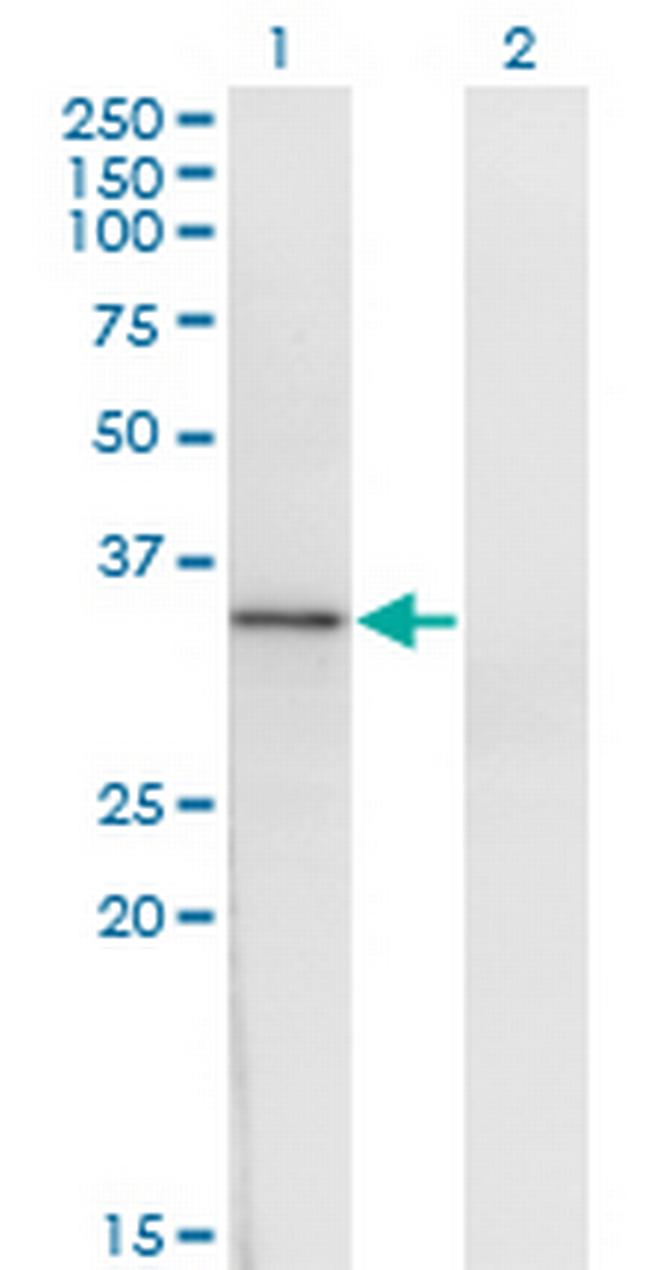 HOXD1 Antibody in Western Blot (WB)