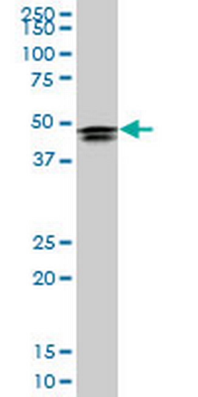 HOXD3 Antibody in Western Blot (WB)