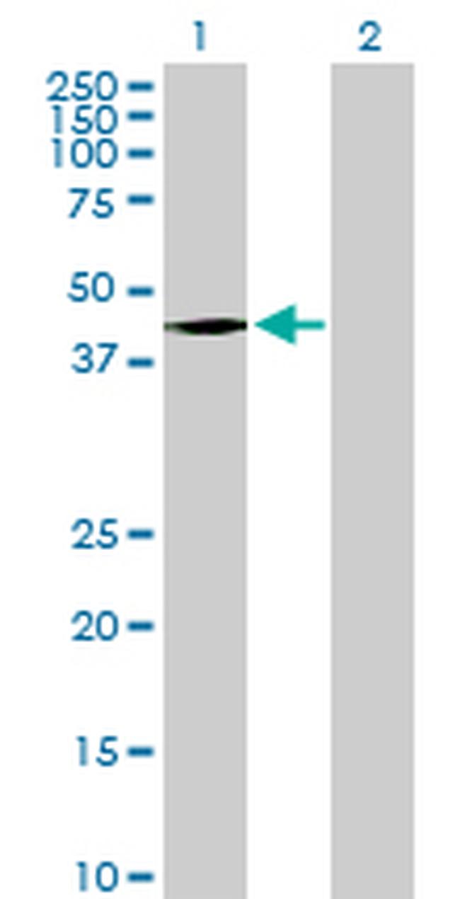 HOXD8 Antibody in Western Blot (WB)