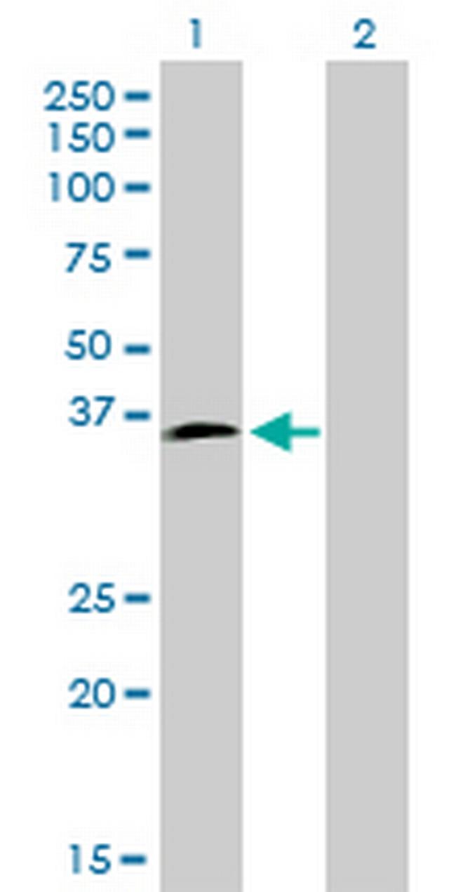 HOXD8 Antibody in Western Blot (WB)