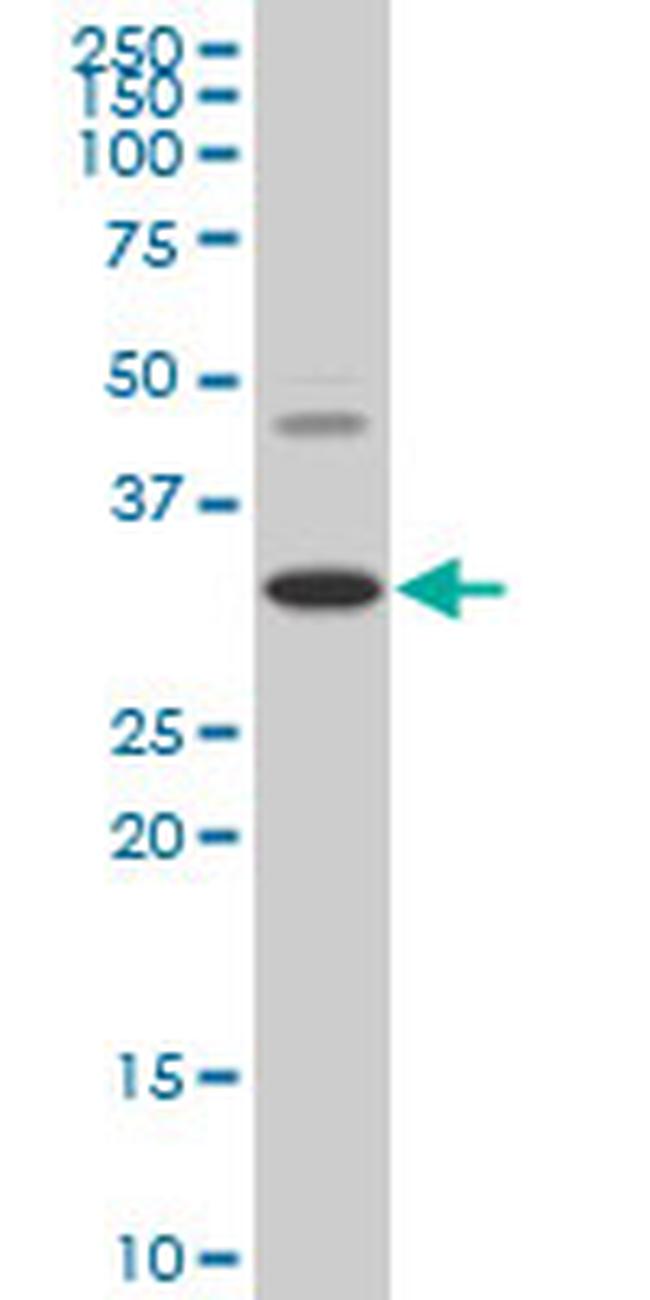 HOXD8 Antibody in Western Blot (WB)