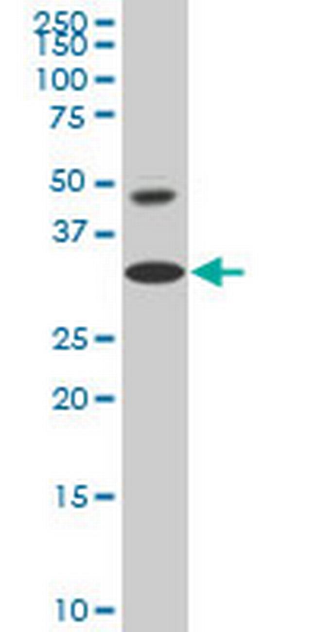 HOXD8 Antibody in Western Blot (WB)