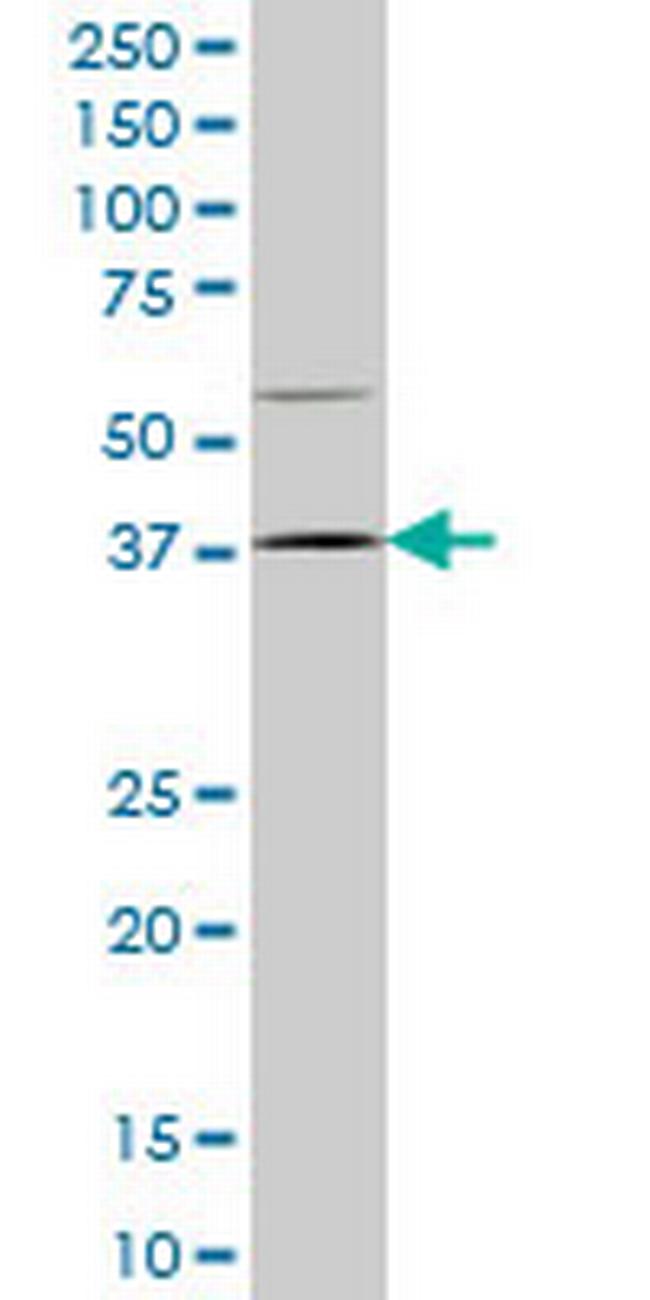 HOXD9 Antibody in Western Blot (WB)