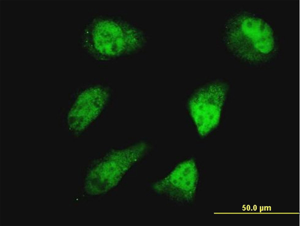 HOXD11 Antibody in Immunocytochemistry (ICC/IF)