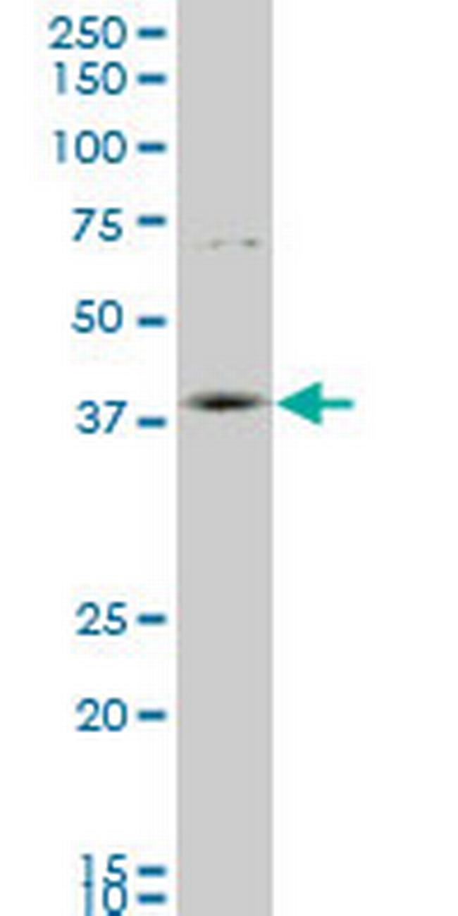 HOXD11 Antibody in Western Blot (WB)