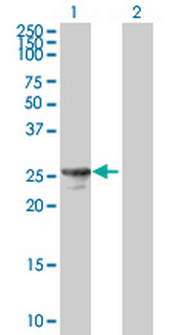 HPGD Antibody in Western Blot (WB)