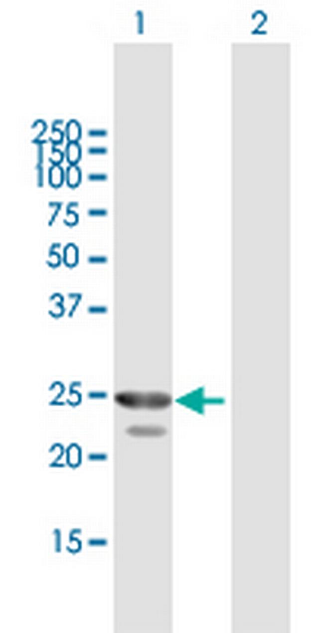 HPGD Antibody in Western Blot (WB)