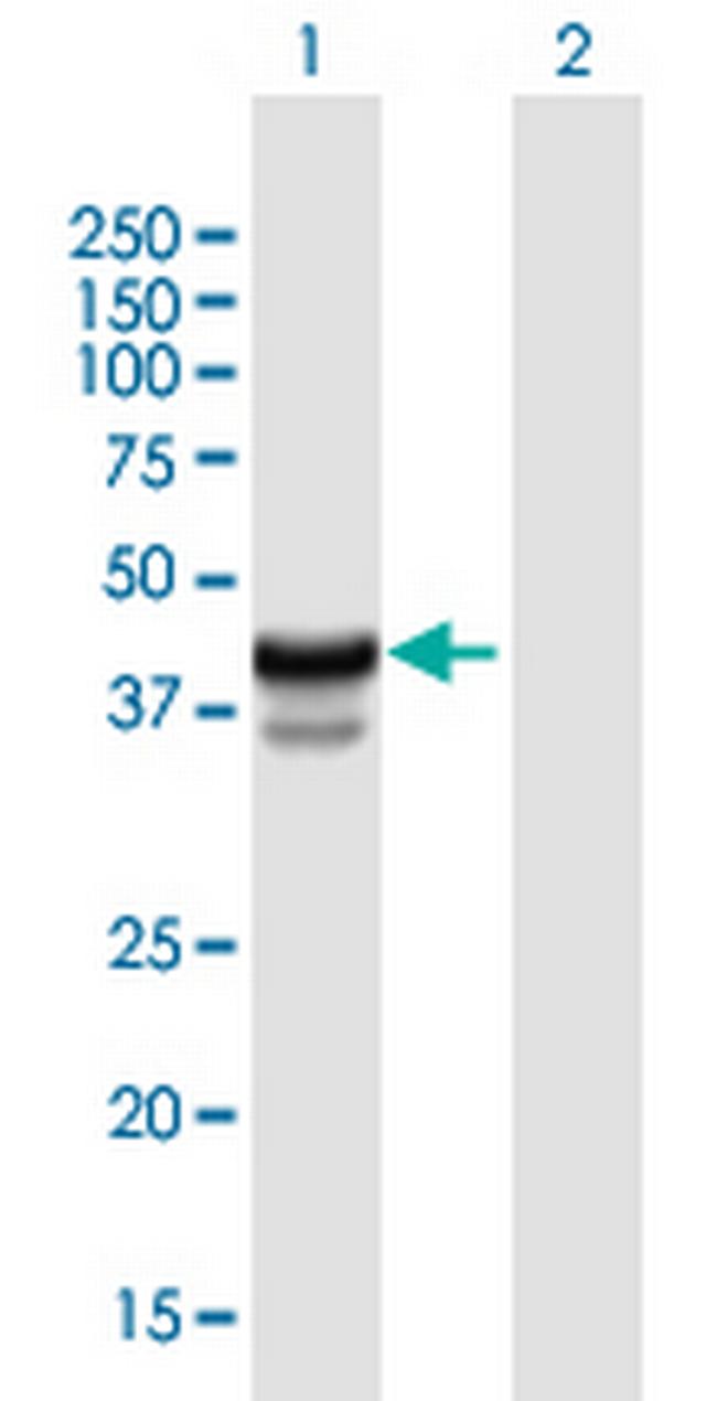 HPR Antibody in Western Blot (WB)
