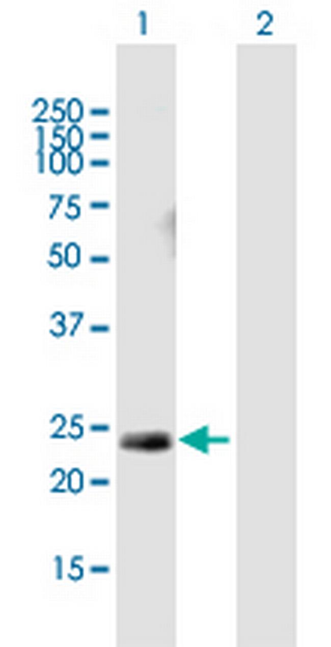 HRAS Antibody in Western Blot (WB)