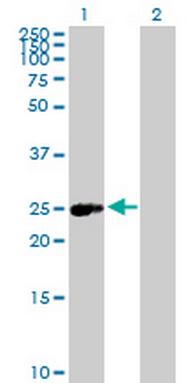 ERAS Antibody in Western Blot (WB)