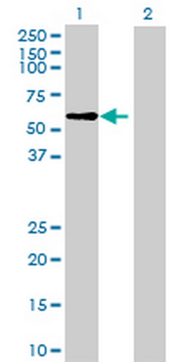 HRB Antibody in Western Blot (WB)