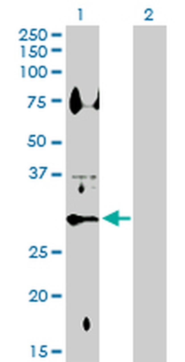 HSD11B1 Antibody in Western Blot (WB)